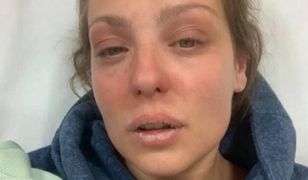 Amy Dowden cierpi na nowotwór. Myślała, że jest na to za młoda