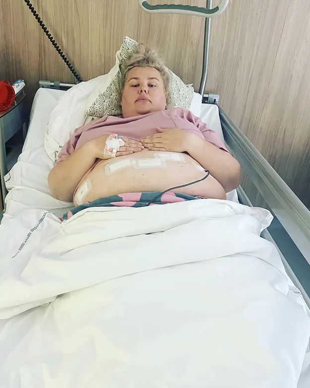 Kinga Zawodnik poddała się operacji bariatrycznej