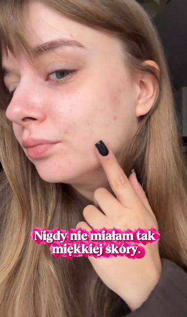 Maseczka z miodu i cynamonu pomaga na problemy z cerą