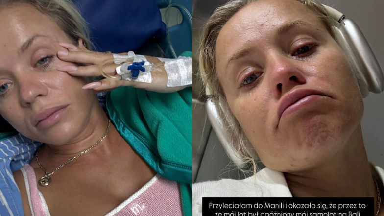 Anna Skura trafiła do szpitala na Bali! 