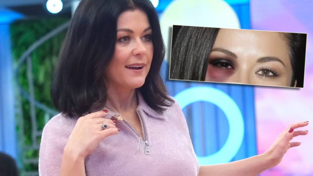 Cichopek z podbitym okiem? (fot. KAPiF, Instagram)