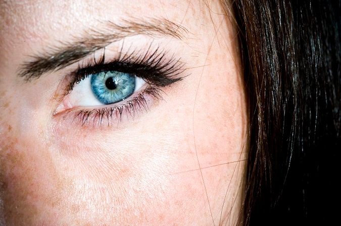 Przebarwienia to powszechny problem, którego przyczyny mogą być złożone