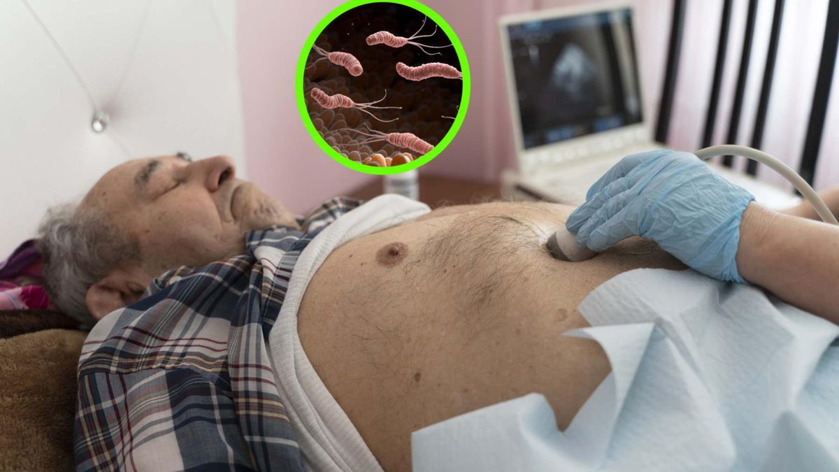 Zaliczany do 10 najbardziej zabójczych raków. "Ten proces może trwać nawet kilkadziesiąt lat"