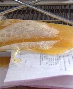 Wrocław: koronawirus. Pacjent "zero" oddał osocze