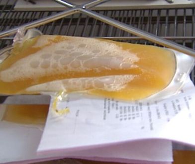 Wrocław: koronawirus. Pacjent "zero" oddał osocze