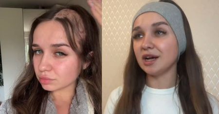 Robiła ciasto na święta, przeżyła horror. Sprzęt "pożarł" jej włosy