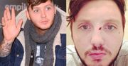 James Arthur POBITY w polskim barze! (FOTO)