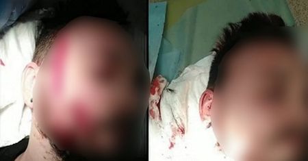 Horror w Gdyni. Pijany mężczyzna zaatakował nożem protestującego