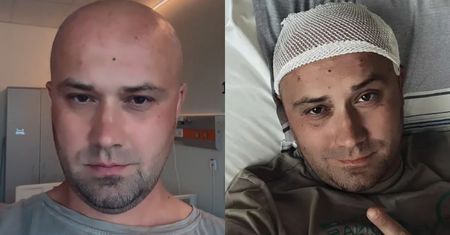 Adrian ze "ŚOPW" przekazał nowe informacje po operacji usunięcia GUZA MÓZGU! "Czy czuję się lepiej? Nie powiedziałbym"