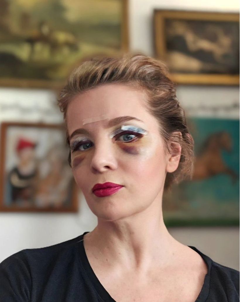 Anna Powierza pokazała się podczas gojenia ran po zabiegach medycyny estetycznej