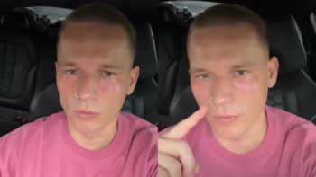 "Jestem prawdziwy Justin Bieber". Schorowany milioner rozpływa się nad swoim wyglądem