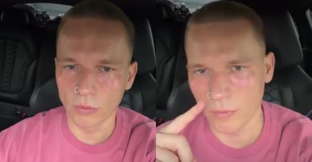 "Jestem prawdziwy Justin Bieber". Schorowany milioner rozpływa się nad swoim wyglądem