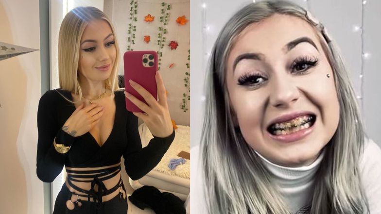 Kinia Wiczyńska chwali się nowymi zębami