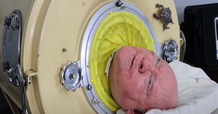 Jego życie zależy od maszyny. "Człowiek w żelaznym płucu" spędził w niej lata