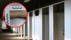 Zdrowa 30-latka nagle zmarła. Czarne kropeczki ujawniły przyczynę zgonu