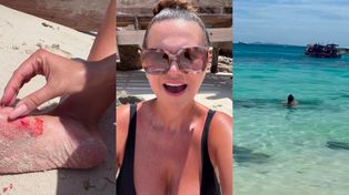 Maja Rutkowski ROZCIĘŁA NOGĘ w Tajlandii. Krew się leje a celebrytka apeluje: "Nie pływajcie nad kamieniami, bo to NIEBEZPIECZNE"