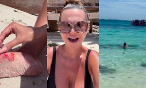 Maja Rutkowski ROZCIĘŁA NOGĘ w Tajlandii. Krew się leje a celebrytka apeluje: "Nie pływajcie nad kamieniami, bo to NIEBEZPIECZNE"