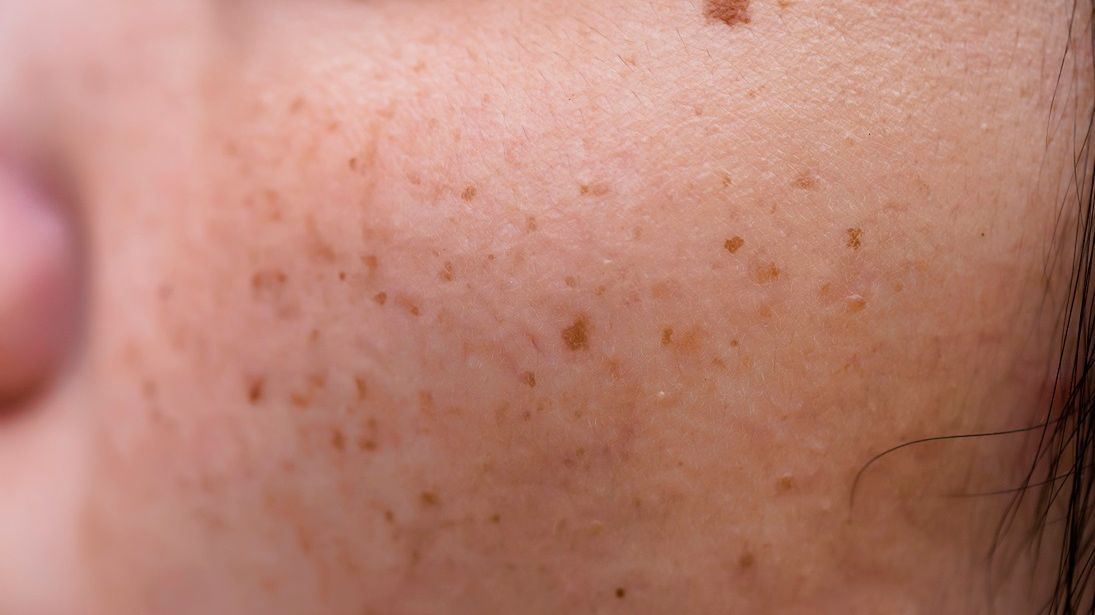 Sygnały ostrzegawcze, które wysyła chora wątroba