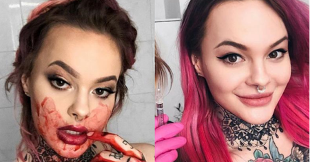 23-letnia Monika Miller opowiada o... zabiegach upiększających. "Rozpuściłam pozostałości tłuszczu!"