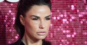 Już dawno straciła ludzkie rysy. Katie Price poddała się kolejnej serii zabiegów