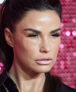 Już dawno straciła ludzkie rysy. Katie Price poddała się kolejnej serii zabiegów