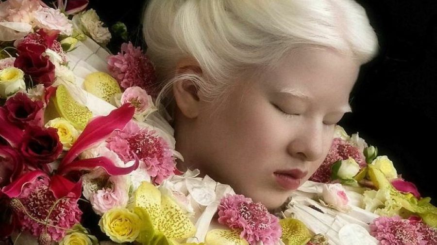 Przez odmienny wygląd porzucili ją rodzice. Teraz Xueli Abbing pozuje dla Vogue 1