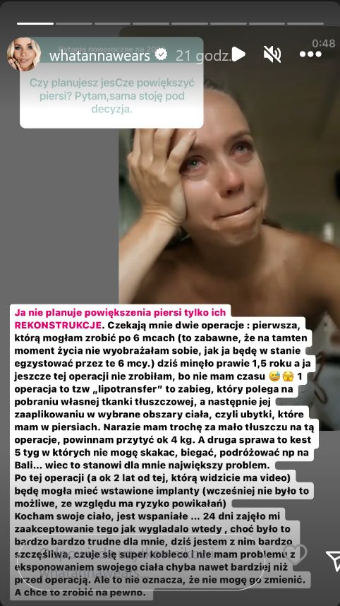 Anna Skura planuje rekonstrukcję piersi