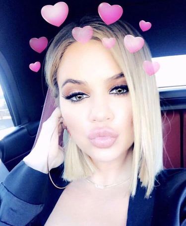 Khloe Kardashian miała operację plastyczną