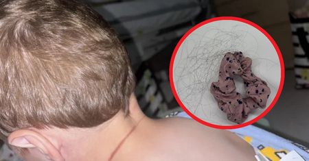 Dwulatek przestał oddychać. Rano odkryła pręgę na jego szyi