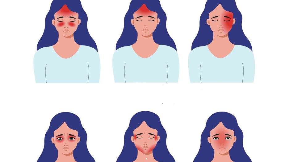 Co oznacza ból głowy w danym miejscu?