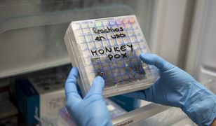 Małpia ospa: jest się czego bać?