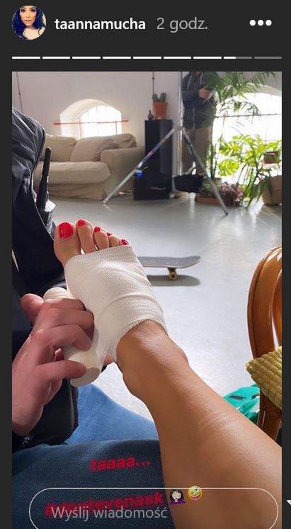 Anna Mucha pokazała swoją kontuzję na InstaStory