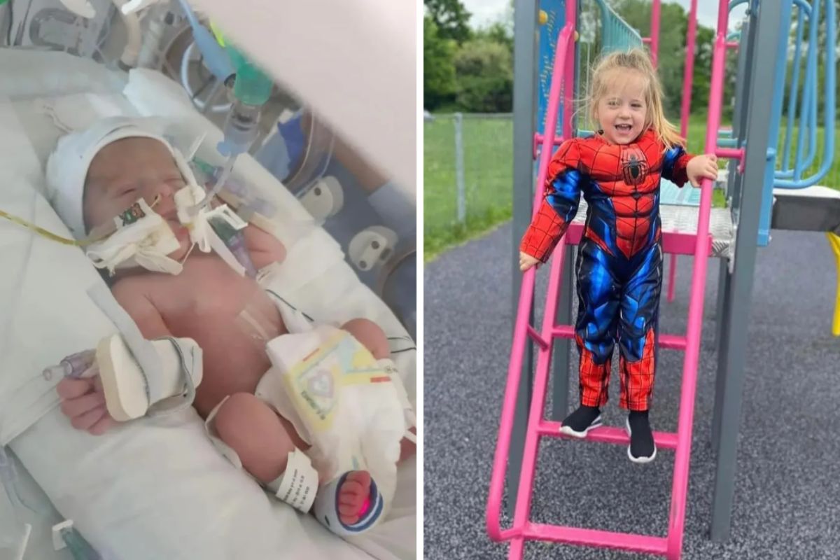 Dziewczynka urodziła się z wadą wrodzoną, wytrzewieniem