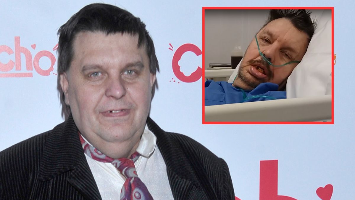 Krzysztof Kononowicz trafił do szpitala