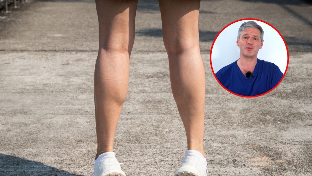 Stań na palcach. Pojawiający się objaw może ujawnić zakrzepicę