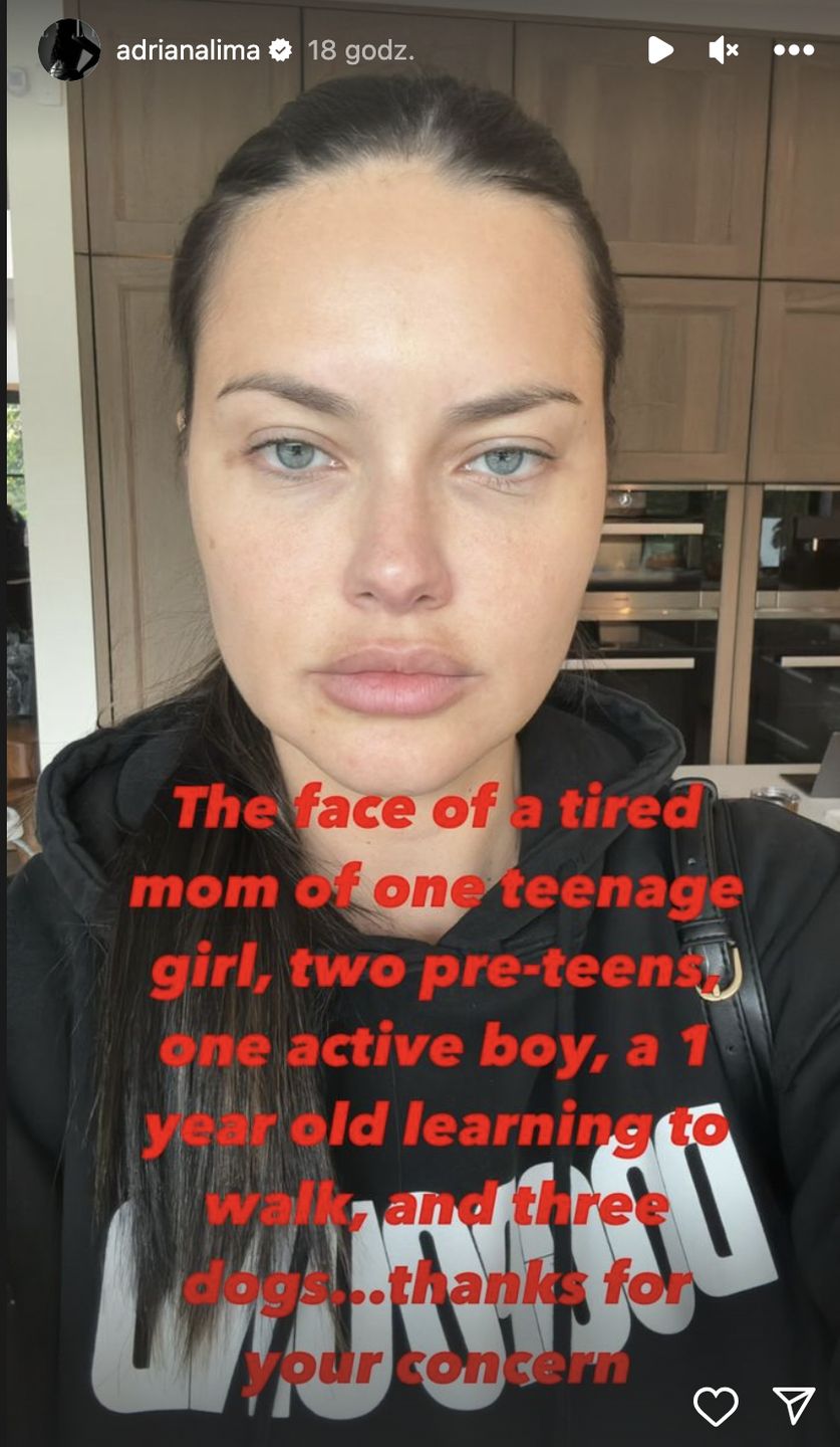 Adriana Lima zabrała głos