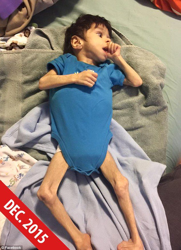 Zaadoptowali 7-latka ważącego 3 kg. Zobacz, jak dzięki nim dziś wygląda