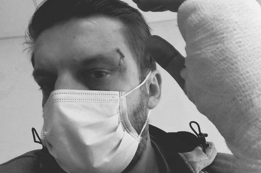 Warszawa. Pan Bartosz został napadnięty przez pijanego, agresywnego pasażera jego taksówki. Chciałby podziękować mężczyźnie, który wybawił go z opresji