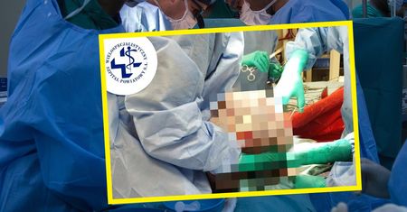 W jej ciele rósł gigantyczny guz. Ważył tyle, co 5-letnie dziecko