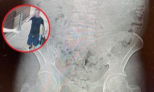 40-latek nerwowo się zachowywał. Oto, co wykazało badanie tomografem