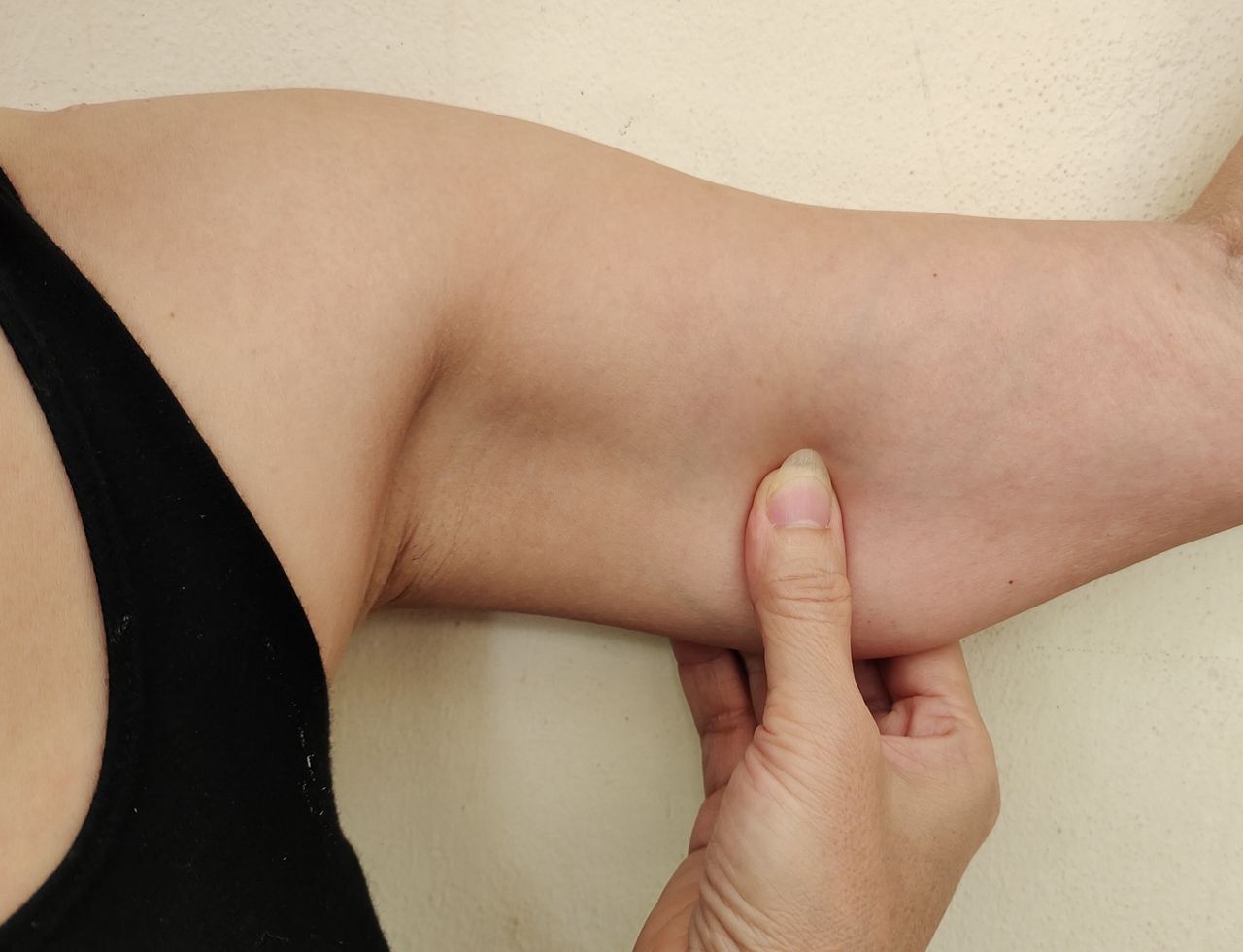 Simple exercises and home remedies to banish 'bat wings'