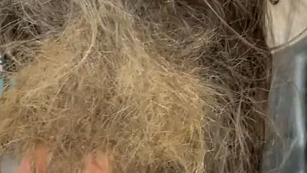 Włosy dziecka przypominały jeden wielki kołtun.