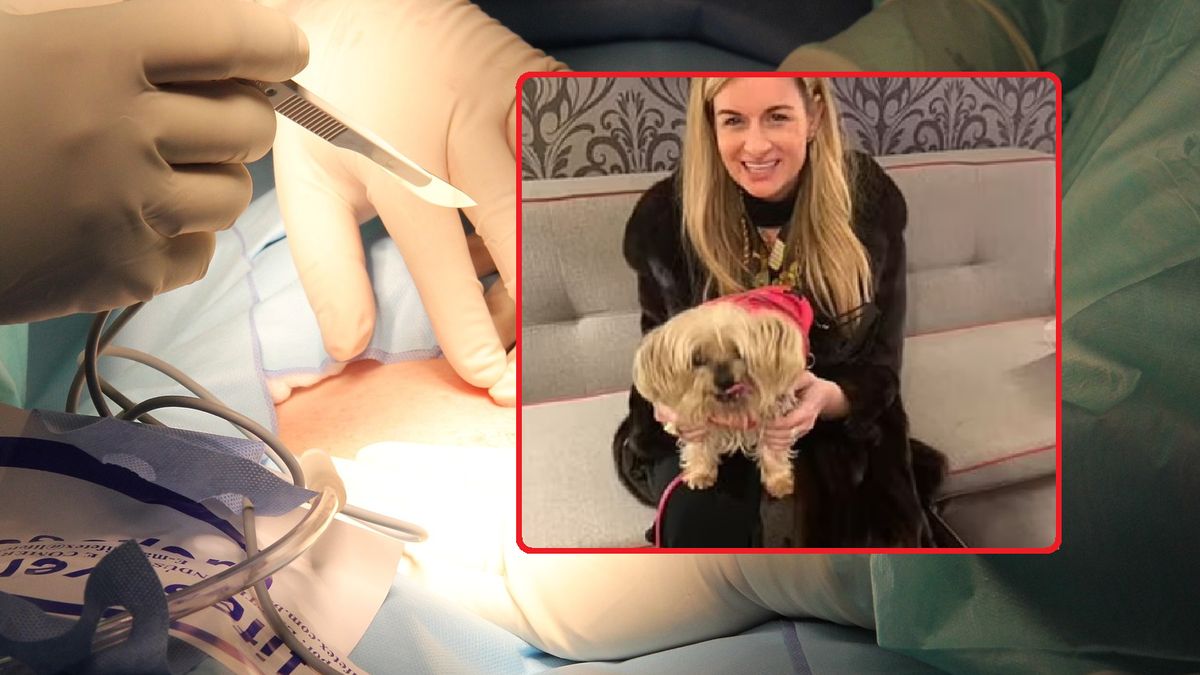 Kobieta zaczęła mówić z obcym akcentem.