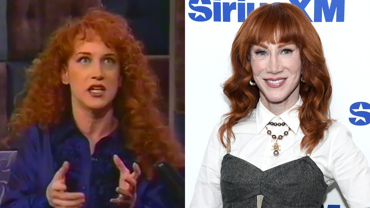 Kathy Griffin przed i po liftingu