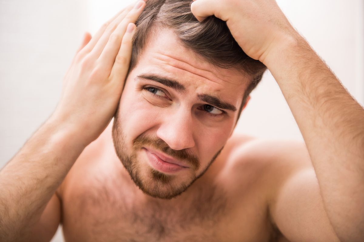 Rodzaje łysienia u mężczyzn - łysienie androgenowe, plackowate i inne