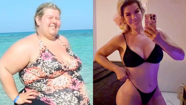 Schudła aż 115 kg. Otwarcie mówi o tym, co z ZABIEGAMI: "Chirurgia plastyczna jest dla ludzi"