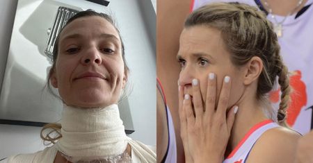 Joanna Koroniewska pozuje owinięta BANDAŻEM i przekonuje: "Nie, to nie jest dieta zmieniająca rysy". Co się stało?