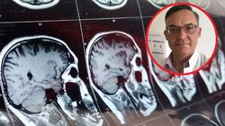 Zabijają lub odbierają sprawność. 5 chorób, które mogą zostać błędnie zdiagnozowane