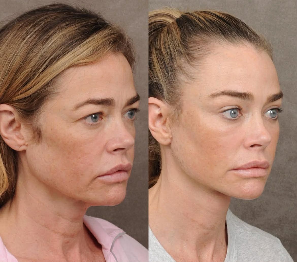 Denise Richards