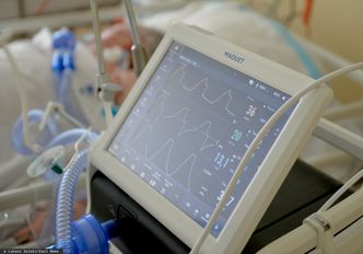 Przekręt na szpitalnym sprzęcie. Ustawione przetargi